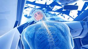 These usually occur as the result of a fall or other accident where the head comes in direct contact with a hard surface or object. X Ray Illustration Of Risk Of Brain Injury While Head On Car Crash Digital Artwork Collision Cars Stock Photo 308611454