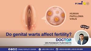 Image result for genital warts