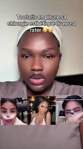 Chirurgie esthétique du nez de Tootatis : échec et émotions