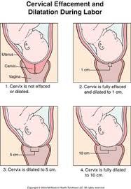 Dilation And Effacement