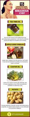 14 Home Remedies To Treat Sebaceous Cysts Remedies Home Remedies Guava Benefits