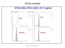 Forensic Toxicology Use Only Analysis Of Etg Ets Using The