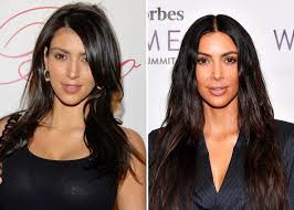 How many kim kardashian plastic surgery procedures were there? Kim Kardashian Is Accused Of Photoshopping Her Nose In An Old Photo
