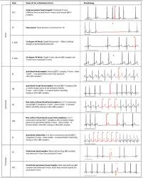 Visual Arrythmia Chart More Vet Tech Student Vet Clinics