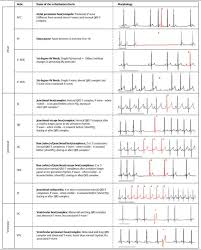 visual arrythmia chart more vet tech student vet clinics