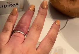 Gambar Gambar Cincin Tunangan Di Jari Wanita