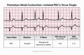 Atrijalna Extrasistola Premature Atrial Contraction Ecg Interpretation Ekg Continuing Education For Nurses