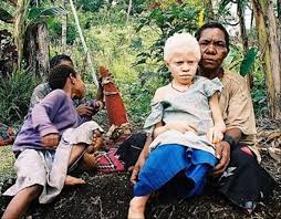 .is the mother tongue of the bantu people living in zanzibar and nearby coastal tanzania; Turkey To Help Children With Albinism In Tanzania