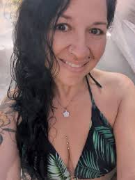 IDNC that i have a port wine stain