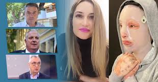 Στο πρόσωπο οι γυναίκες συνήθως το αποφεύγουν, γιατί το έχουν συνδέσει με την ανδρική τριχοφυία. Bitrioli Patrisnews Efhmerida Patris Hleias