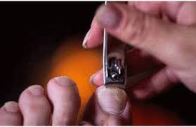 Des plantes au protection de la prostate. Ongle Incarne Comment Soigner Naturellement Un Ongle Incarne Tout Pratique
