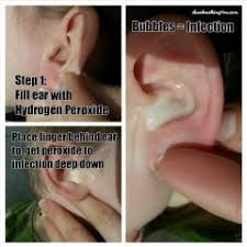 For example, ear congestion can be due to a wax buildup in the please read my article on the best home remedies for a sinus infection for detailed instructions on how to do a saline rinse to clear your sinuses and relieve. 11 Clogged Ears Ideas Ear Infection Remedy Clogged Ears Health Remedies