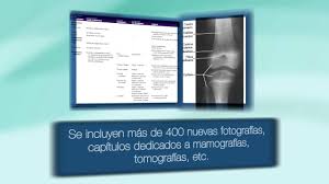 Manual de posiciones y tecnicas radiologicas gratis. Proyecciones Radiologicas Con Correlacion Anatomica De Bontrager Youtube