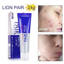 Cara nak hilangkan parut jerawat. 10 Produk Hilangkan Parut Jerawat Dengan Cepat Dan Berkesan Bidadari My