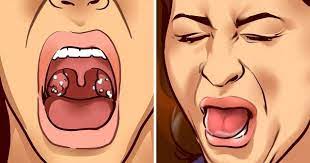 9 Things A Bad Taste In Your Mouth Is Trying To Tell You Bad Taste In Mouth Bad Breath Bitter Taste In Mouth