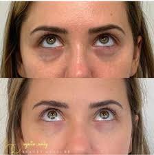 Welcome to Beauty Culture Med Spa