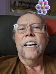I had surgery with Bionic Smile and received temporary teeth