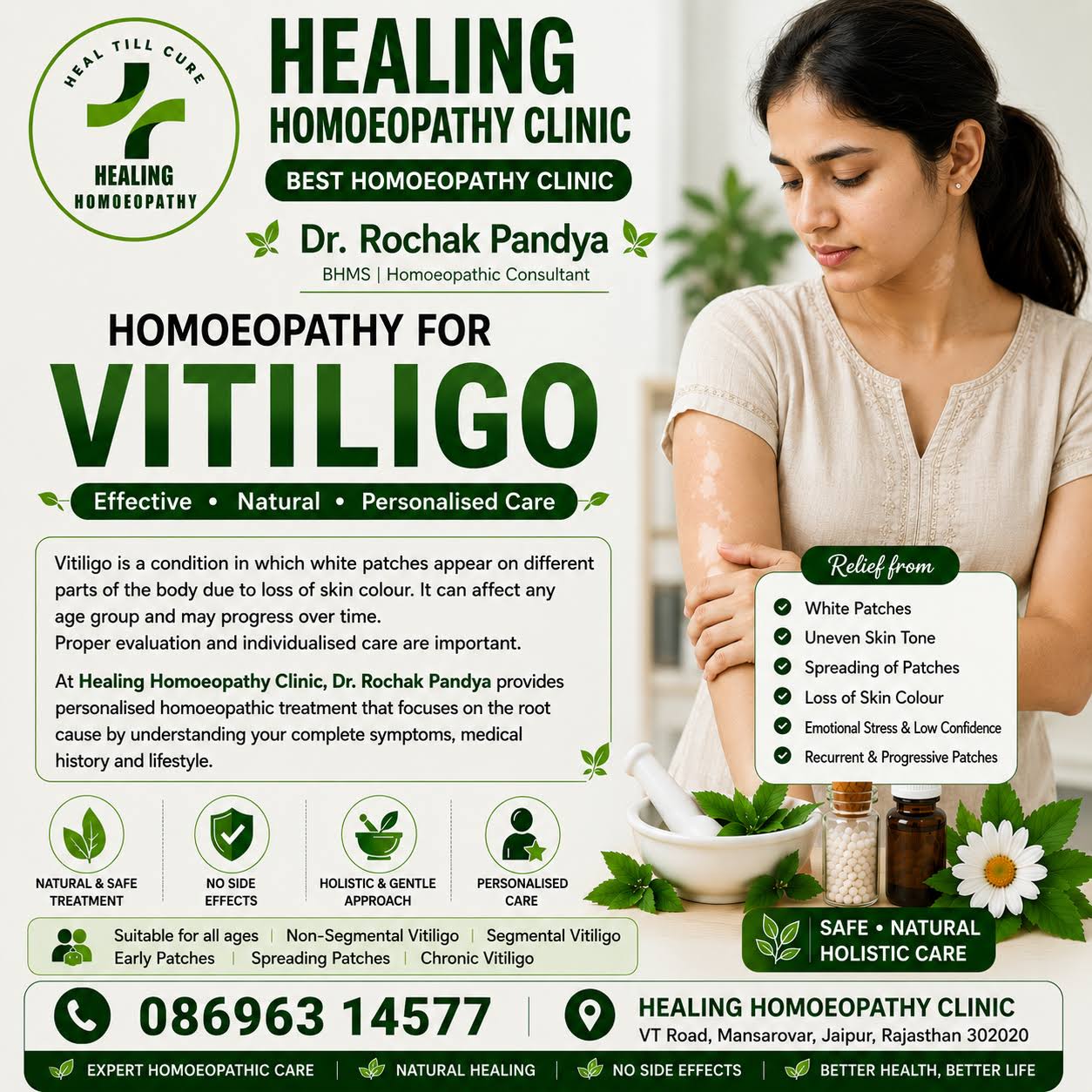 VITILIGO