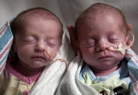 Twins, twins and more twins: Saint Mary's seeing double in neonatal  intensive care unit