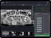 Denti.AI: AI for Dental X-Ray Imaging and Voice Charting