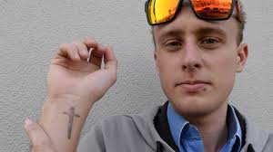 Magnolia med spa is a full service spa that offers wide spectrum of treatments and products to give our clients the best possible results. Laser Tattoo Removal Leaves 20 Year Old With Severe Burns The Courier Mail