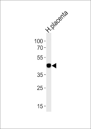 Dylight® 650 has amax = 652 nm, emax = 672 nm. Rbpj Peptide Mybiosource