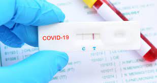 Results same day by 10 pm, if swabbed before 11 am. Rapid Covid 19 Test Available All Locations Mydoc Urgent Care