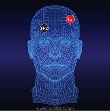 Depression And Anxiety Total Tdcs Electrode Placement