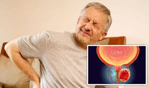 In fact, more than two out of three cases of metastatic. Prostate Cancer Persistent Back Pain Could Be A Warning Sign Of The Disease Express Co Uk
