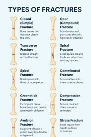 Image result for Fracture Types