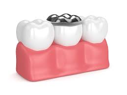 Pin On Dental Care