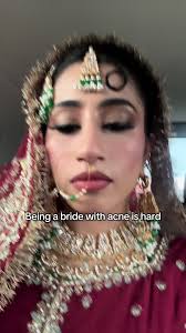 Dealing with Acne as a Bride: My Journey