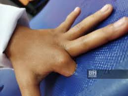 Jika anda menyukai pengantin perempuan, anda mungkin sukakan idea ini. Jari Murid Perempuan Tersepit Di Lubang Kerusi