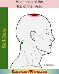 Self Care Headache On The Top Of Your Head Integrative Works Headache Forward Head Posture Self Care