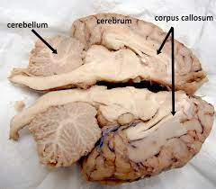 Sheep Brain Dissection Guide Medical Anatomy Medical Student Study Medicine Student