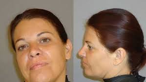 Florida Mug Shots: July 25