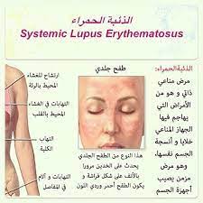We did not find results for: Ù…Ø±Ø¶ Ø§Ù„Ø°Ø¦Ø¨Ø© Ø§Ù„Ø­Ù…Ø±Ø§Ø¡ Ù…Ø§Ù‡Ùˆ Ù…Ø±Ø¶ Ø§Ù„Ø°Ø¦Ø¨Ø© Ø§Ù„Ø­Ù…Ø±Ø§Ø¡ Ù‚ØµØ© Ø´ÙˆÙ‚