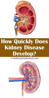 Kidney Stones Meals Kidney Disease Symptoms Polycystic Kidney Disease Kidney Disease