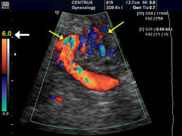 Sweeps for b mode and yield anomalous images in. Doppler Ultrasound Principles And Practice