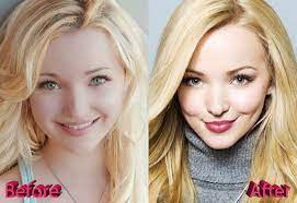 Find the perfect dove cameron stock photos and editorial news pictures from getty images. Dove Cameron Plastic Surgery A Few Suspicious Changes