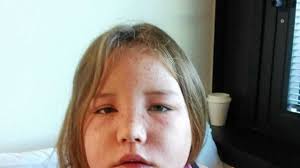 Little warrior's fight for life after rare allergic reaction