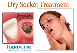 Pin On Dental To Know