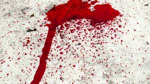 Use a cold, wet washcloth on the stain, and scrub the area very gently. Blood Dropping Onto Wood Floor Stock Footage Video 100 Royalty Free 15653989 Shutterstock