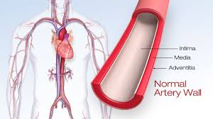 You have one of these arteries on each side of your neck. Atherosclerosis American Heart Association