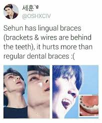 Nooo All Because Idols Supposedly Loose Visual Points Because Of Braces Exo Memes Exo Funny Exo Sehun