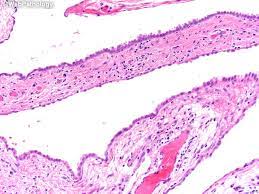 We did not find results for: Webpathology Com A Collection Of Surgical Pathology Images