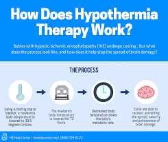 Treating Hie Hypothermia Therapy Brain Cooling