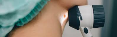 You might be born wi. Melanoma Screening Clinic Newcastle Hospitals Nhs Foundation Trust