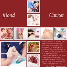 Leukemia, a type of cancer found in your blood and bone marrow, is caused by the rapid production of abnormal white blood cells. Blood Cancer Please Visit At Link To Read More About By Hawn Bingham Medium