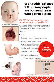 Healthy Living Choices Can Prevent Birth Defects Birth Defects Preventing Birth Defects Cleft Lip And Palate